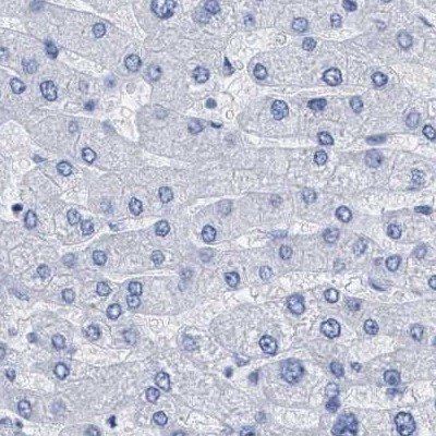 HAPLN1 Antibody in Immunohistochemistry (IHC)