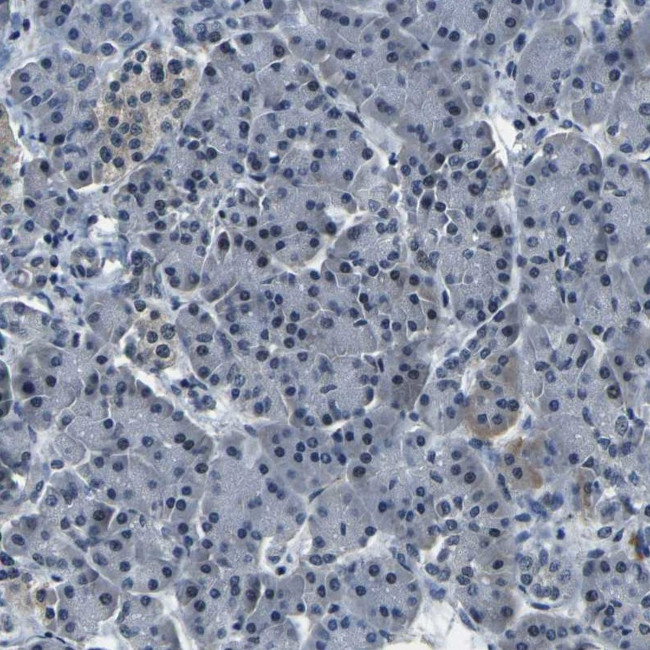 ING2 Antibody in Immunohistochemistry (IHC)