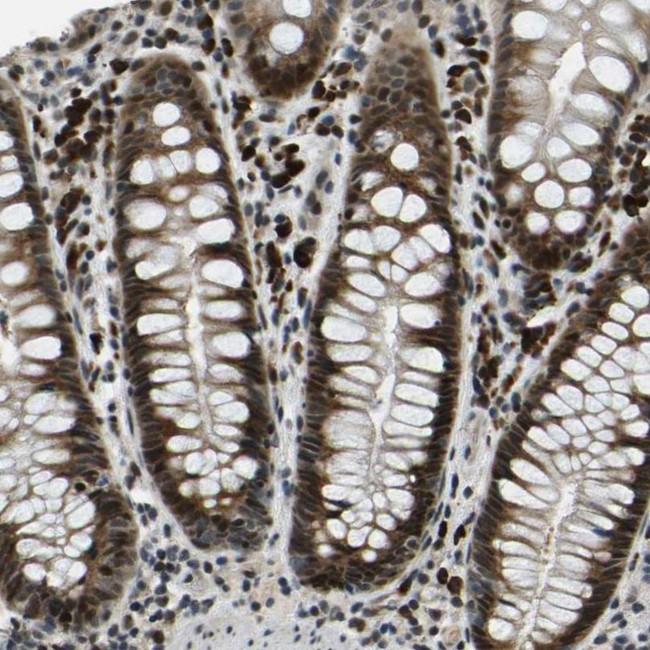 ING2 Antibody in Immunohistochemistry (IHC)