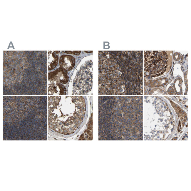 SAMD9L Antibody in Immunohistochemistry (IHC)