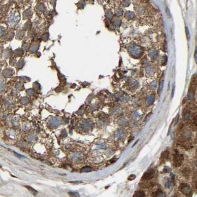 SAMD9L Antibody in Immunohistochemistry (IHC)