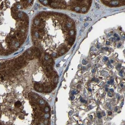 SAMD9L Antibody in Immunohistochemistry (IHC)