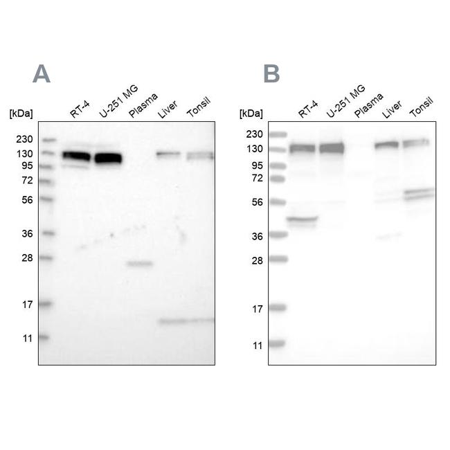 ERC1 Antibody in Western Blot (WB)