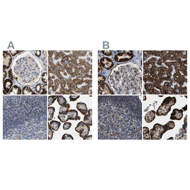 HIBADH Antibody in Immunohistochemistry (IHC)