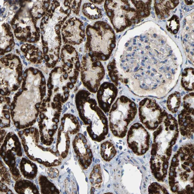 HIBADH Antibody in Immunohistochemistry (IHC)