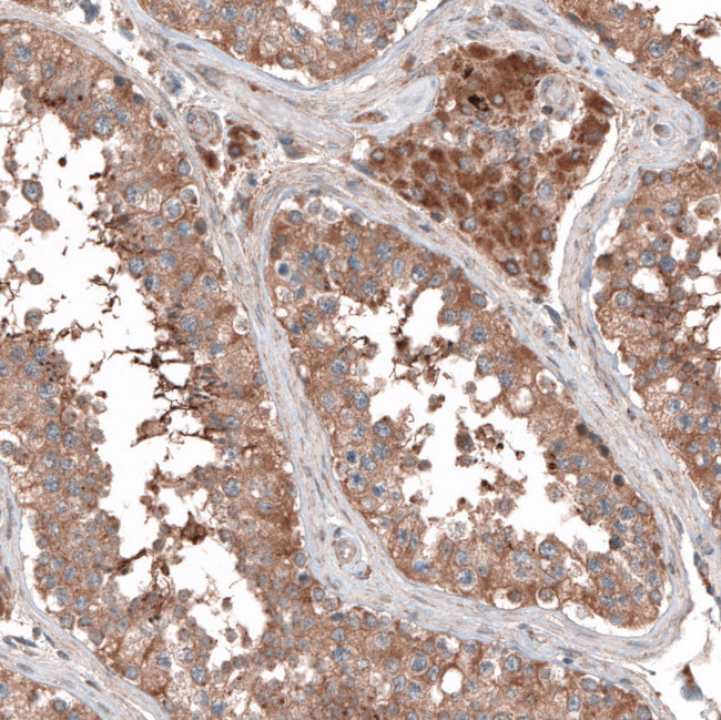 PER3 Antibody in Immunohistochemistry (IHC)