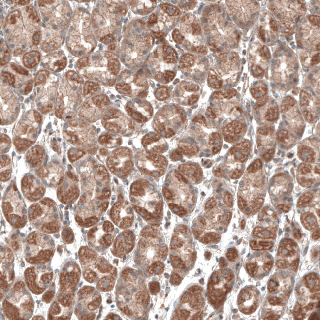 PER3 Antibody in Immunohistochemistry (IHC)