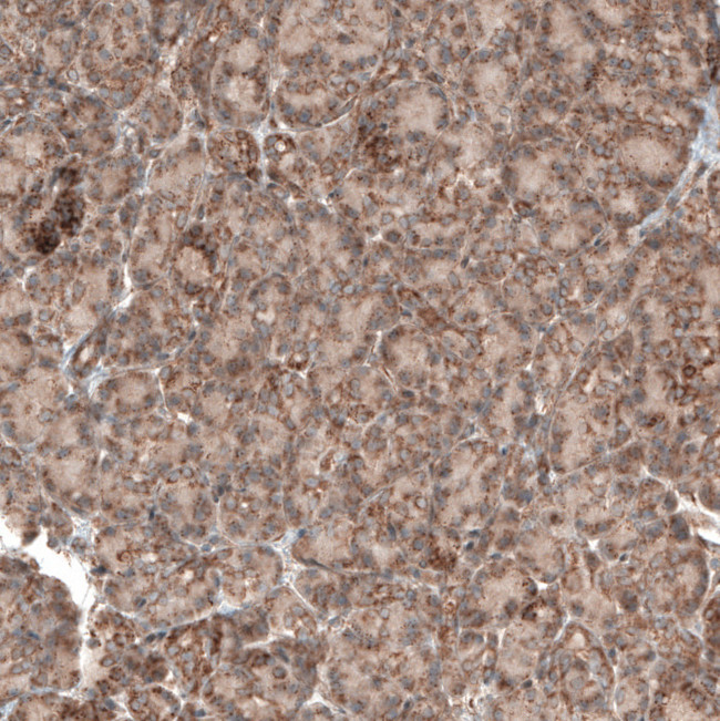 PER3 Antibody in Immunohistochemistry (IHC)