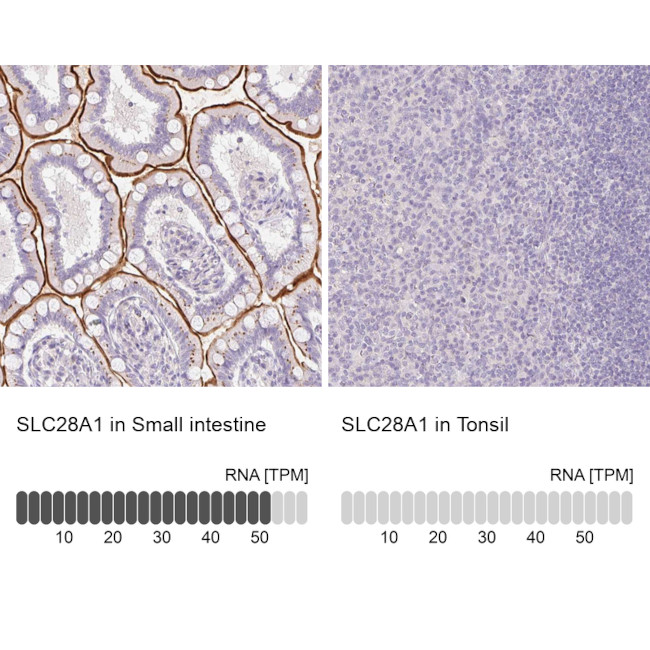 SLC28A1 Antibody in Immunohistochemistry (IHC)