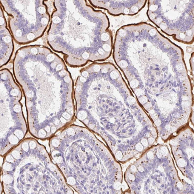 SLC28A1 Antibody in Immunohistochemistry (IHC)