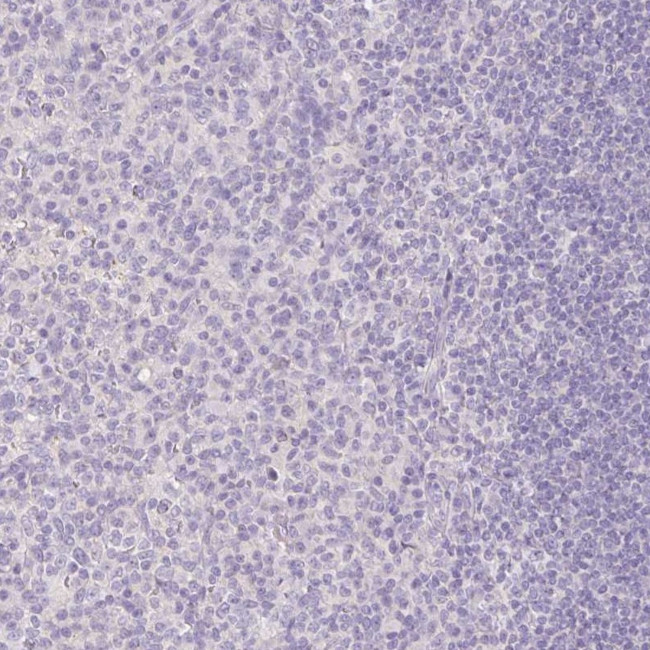 SLC28A1 Antibody in Immunohistochemistry (IHC)