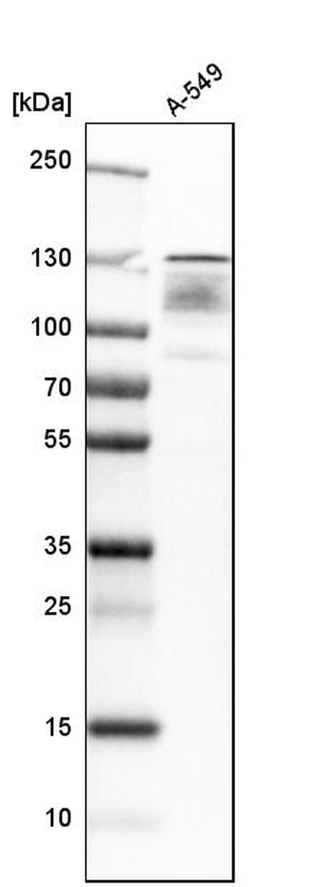 UPF1 Antibody in Western Blot (WB)