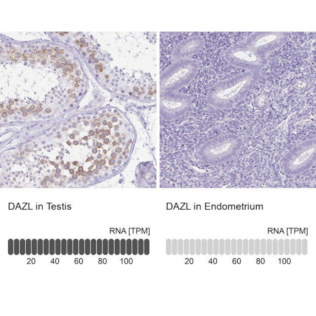 DAZL Antibody in Immunohistochemistry (IHC)