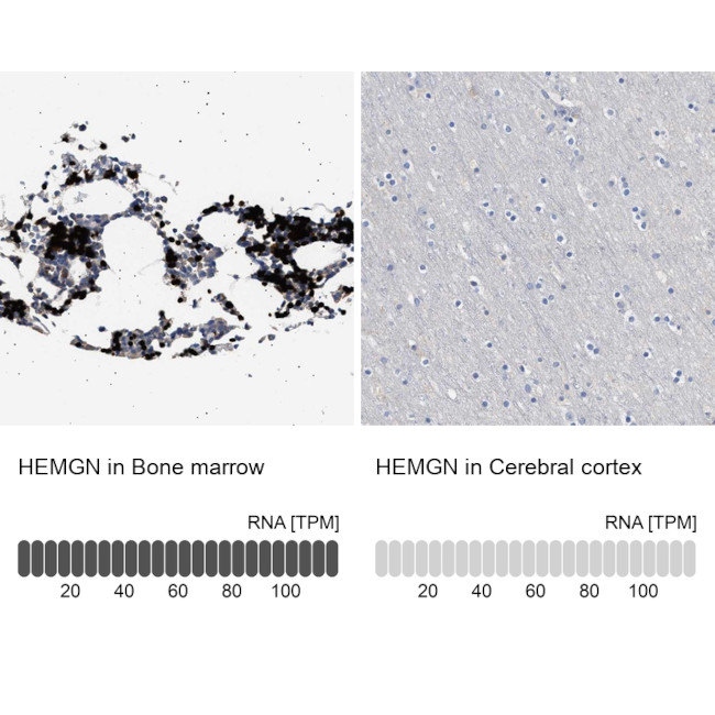 HEMGN Antibody in Immunohistochemistry (IHC)