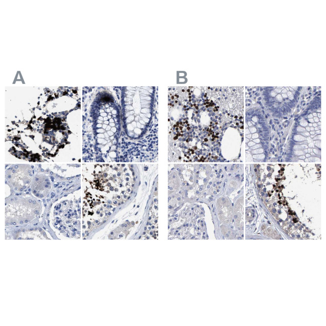 HEMGN Antibody in Immunohistochemistry (IHC)