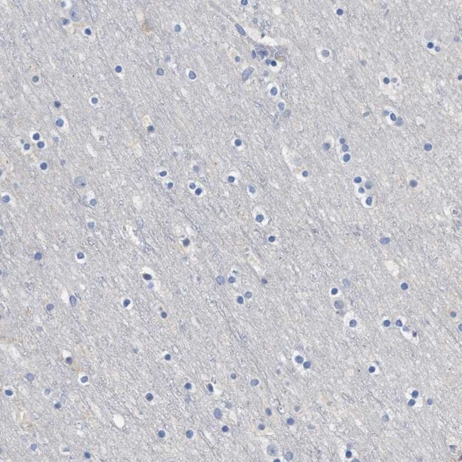 HEMGN Antibody in Immunohistochemistry (IHC)