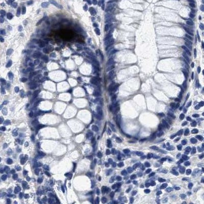 HEMGN Antibody in Immunohistochemistry (IHC)