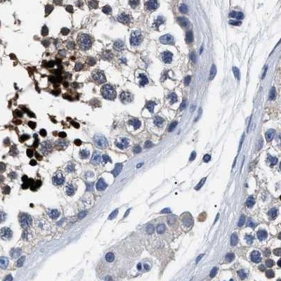 HEMGN Antibody in Immunohistochemistry (IHC)