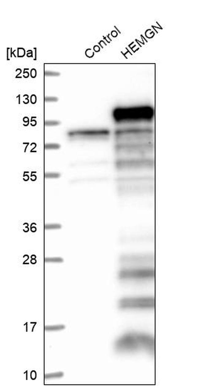 HEMGN Antibody in Western Blot (WB)