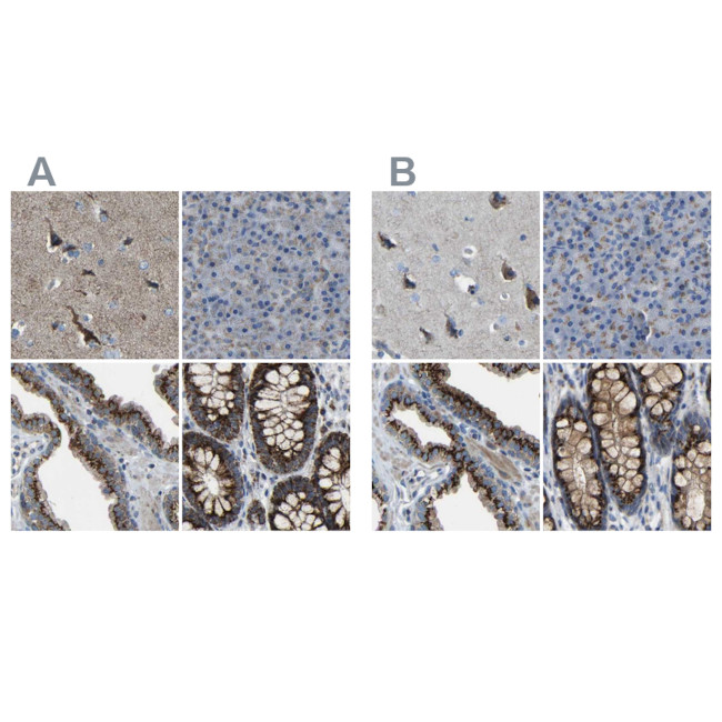 CANT1 Antibody in Immunohistochemistry (IHC)