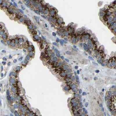 CANT1 Antibody in Immunohistochemistry (IHC)