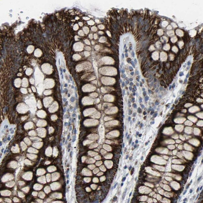 CANT1 Antibody in Immunohistochemistry (IHC)