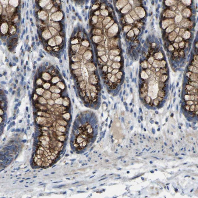 CANT1 Antibody in Immunohistochemistry (IHC)