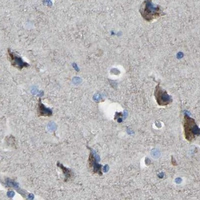 CANT1 Antibody in Immunohistochemistry (IHC)