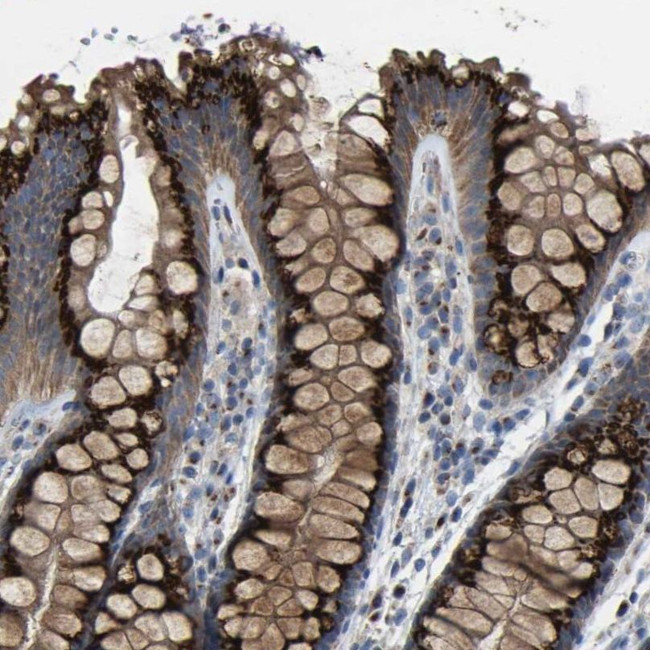 CANT1 Antibody in Immunohistochemistry (IHC)