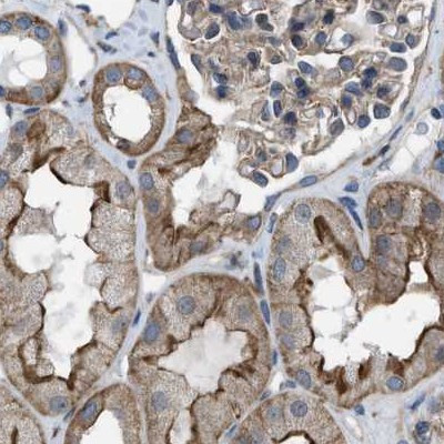 MYO18A Antibody in Immunohistochemistry (IHC)