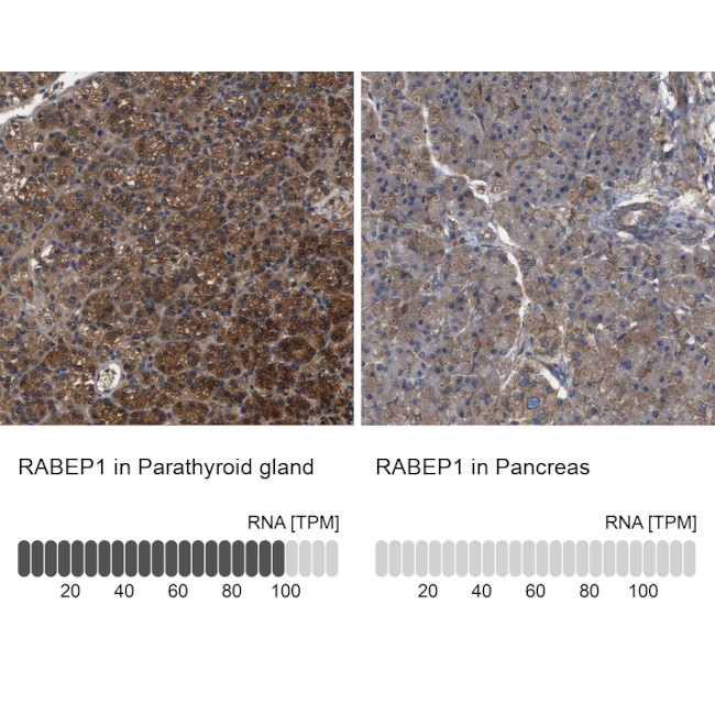 RABEP1 Antibody in Immunohistochemistry (IHC)