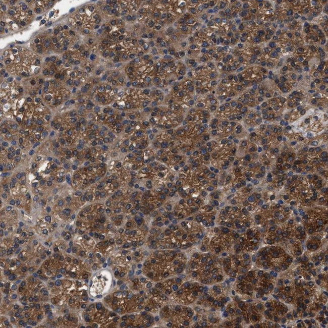 RABEP1 Antibody in Immunohistochemistry (IHC)