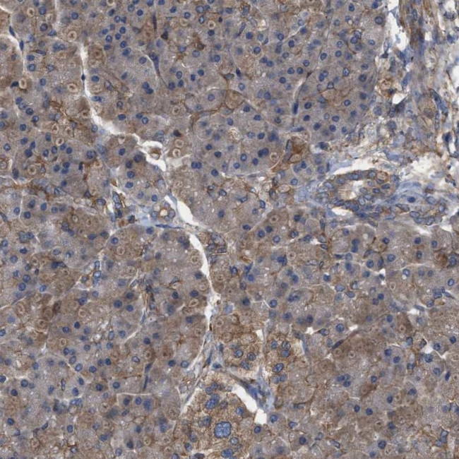 RABEP1 Antibody in Immunohistochemistry (IHC)