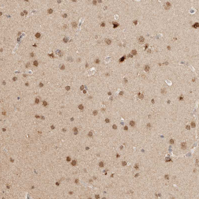 NPAS2 Antibody in Immunohistochemistry (IHC)