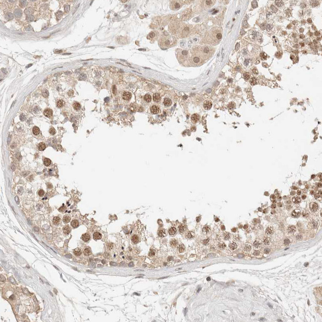 NPAS2 Antibody in Immunohistochemistry (IHC)