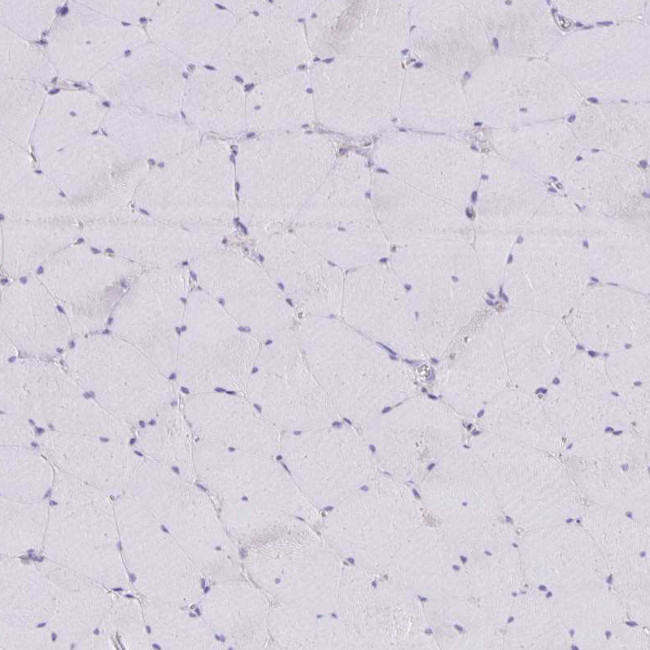 NOV Antibody in Immunohistochemistry (IHC)