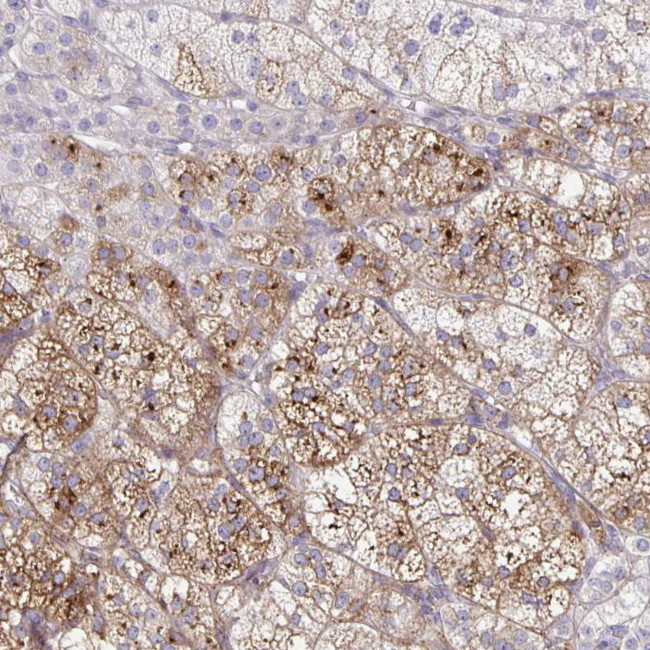 NOV Antibody in Immunohistochemistry (IHC)