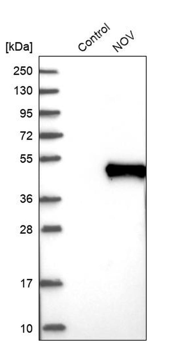 NOV Antibody in Western Blot (WB)