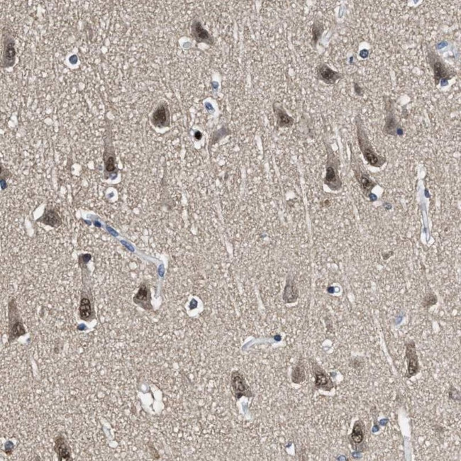 LANCL2 Antibody in Immunohistochemistry (IHC)