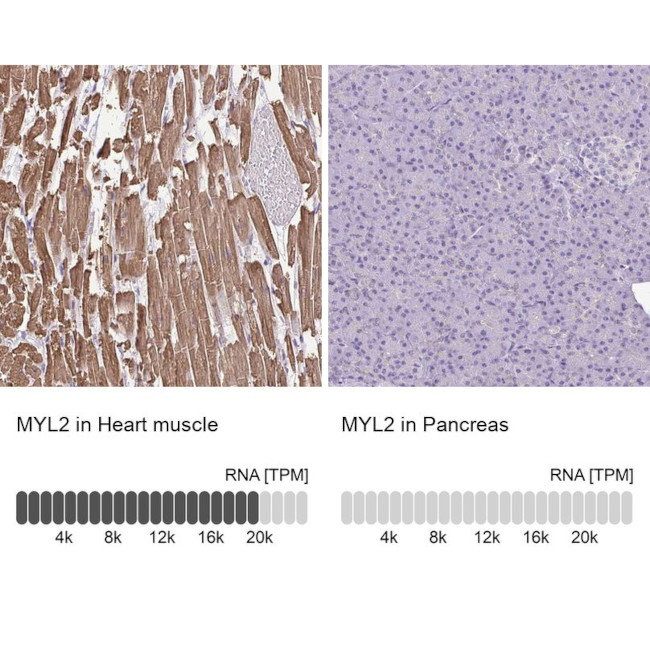 MYL2 Antibody