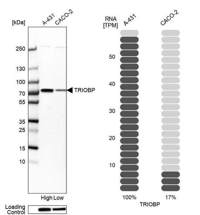 Tara Antibody in Western Blot (WB)