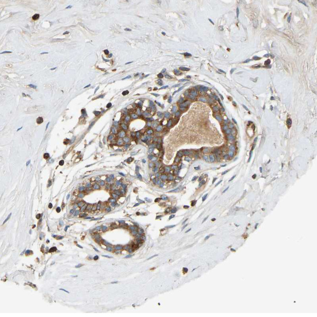 AKAP13 Antibody in Immunohistochemistry (IHC)