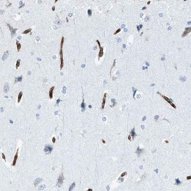 SLC22A15 Antibody in Immunohistochemistry (IHC)