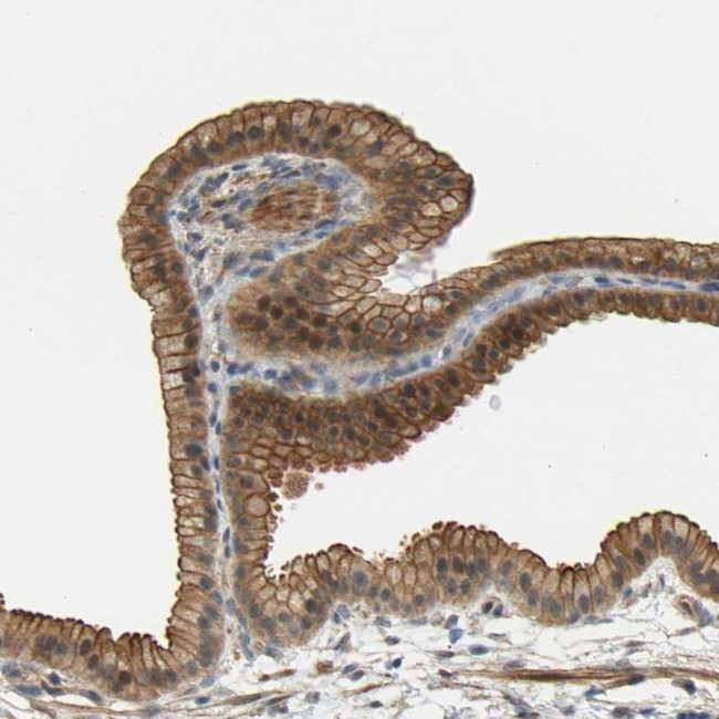 RGL1 Antibody in Immunohistochemistry (IHC)