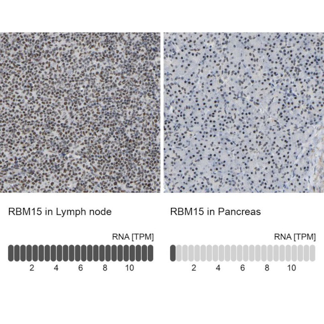 RBM15 Antibody