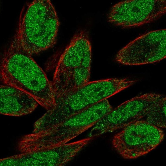 PHIP Antibody in Immunocytochemistry (ICC/IF)