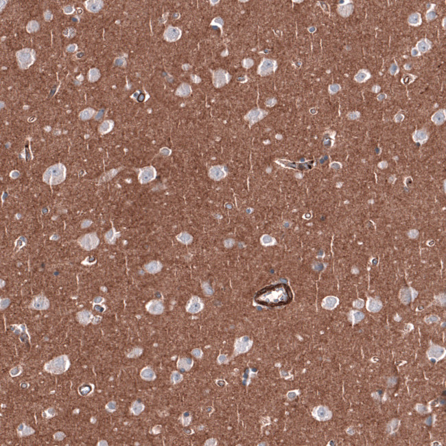 RAB27B Antibody in Immunohistochemistry (IHC)