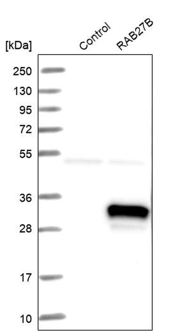 RAB27B Antibody in Western Blot (WB)