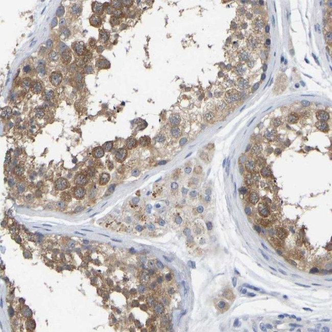 WIPI2 Antibody in Immunohistochemistry (IHC)