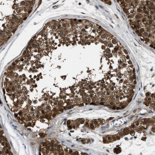 PPA1 Antibody in Immunohistochemistry (IHC)